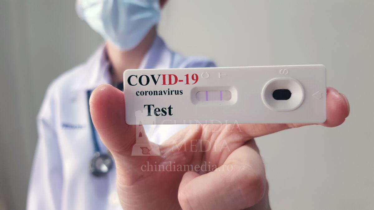 You are currently viewing SANATATE: Testele rapide pentru depistare Covid 19, interzise la vânzare în farmacii